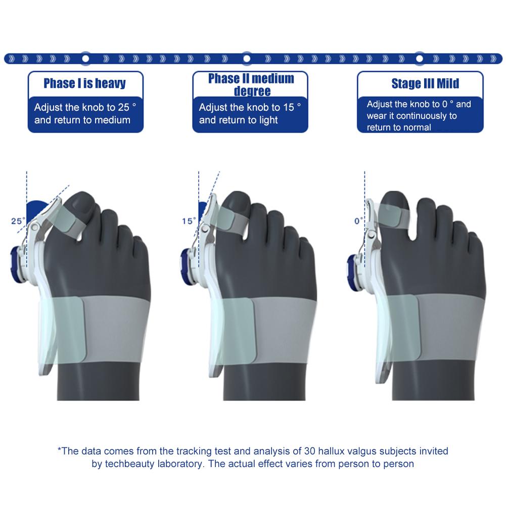 thumbnail image 3 of Kuymtek Férula para Juanetes Corrector Dedo Del Pie Perilla Ajustable Hallux Valgus (Azul), 3 of 10